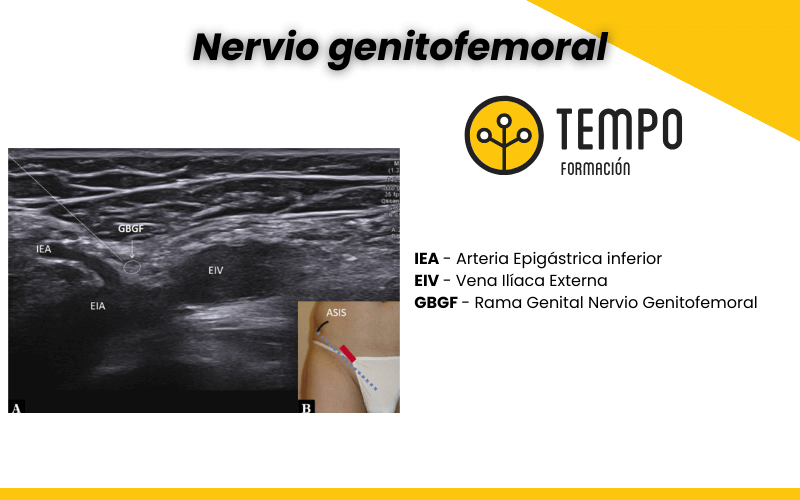 1. Nervio genitofemoral ecografia tempo formacion.png